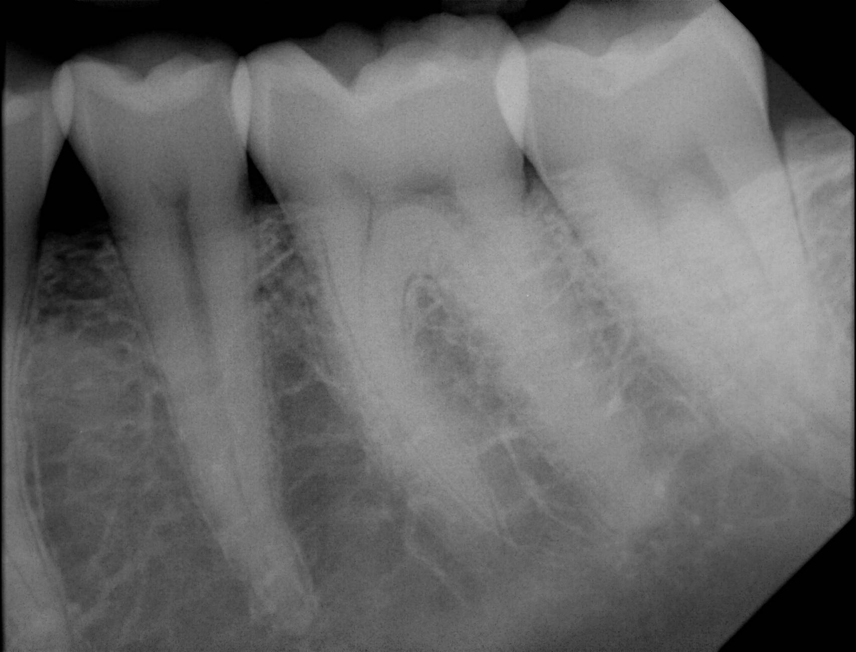 Apex sample X-ray 17