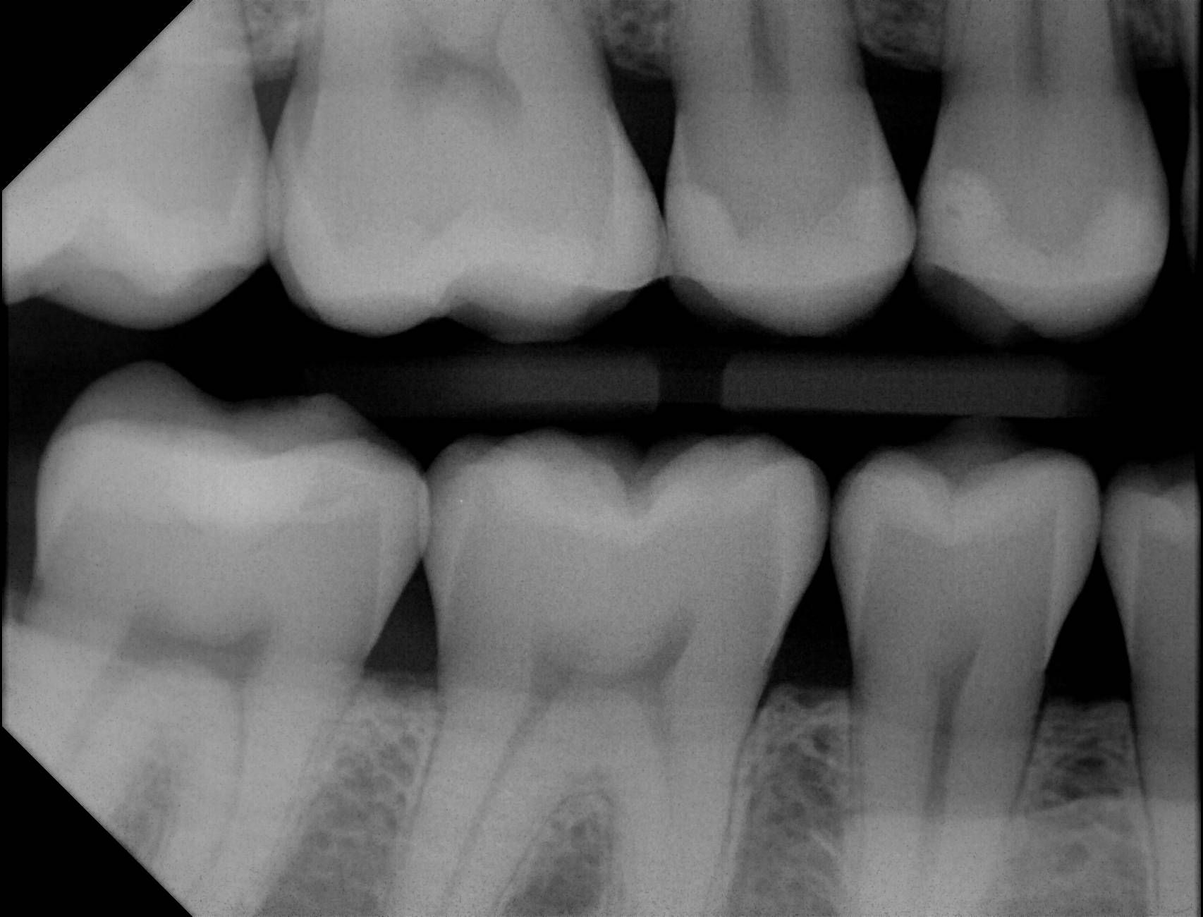 Apex sample X-ray 9