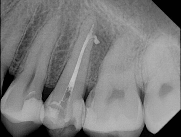 Apex sample X-ray · 8/21/2018
